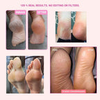 Askom Callus Remover