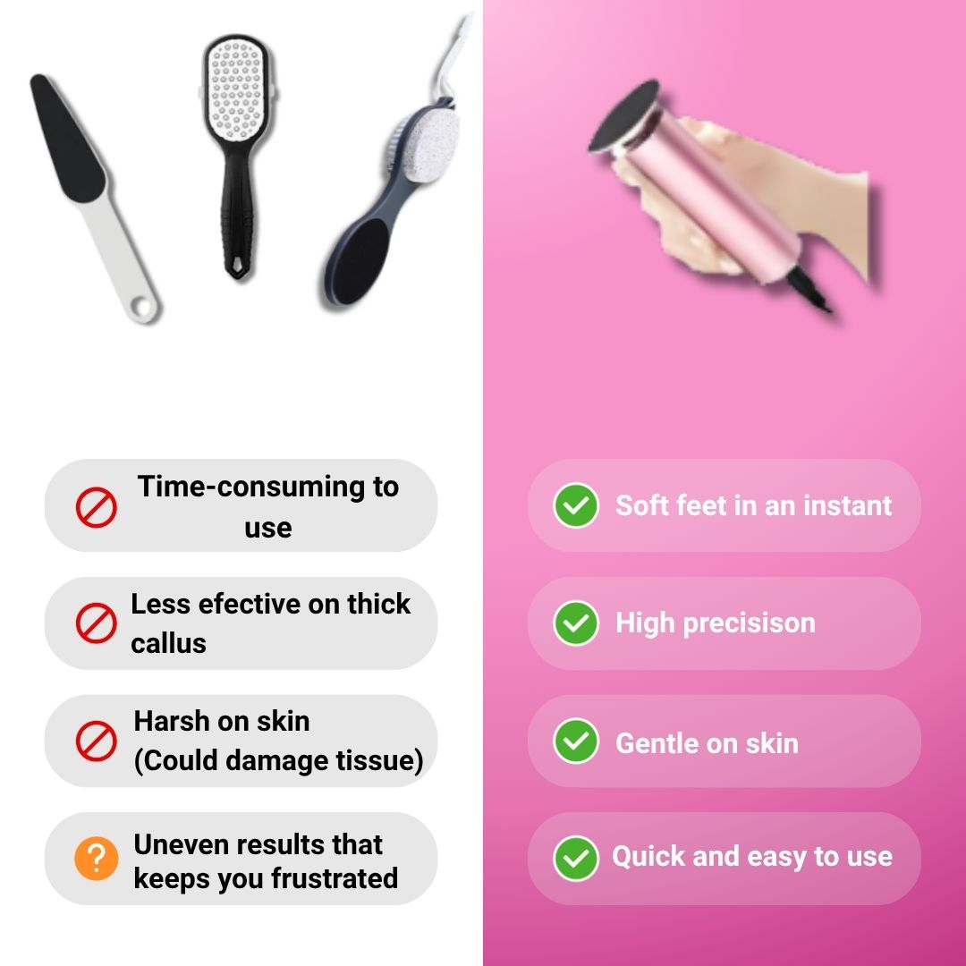 Askom Callus Remover